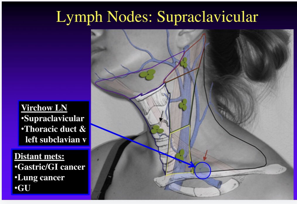 supraclavicular lymph nodes diagram