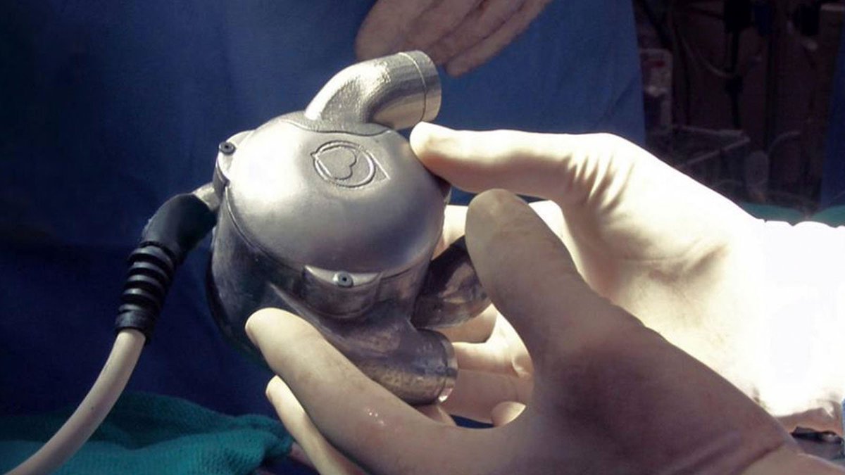 JWPMConsulting's tweet photo. Australian Venture Capital firm at the heart of innovation #BIVACOR #Artificial #hearttransplant #biomedical #Innovation https://t.co/JNjHtxvLFu https://t.co/VPPWeTiQDk