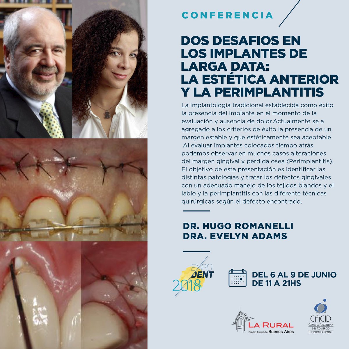 expodentBA's tweet photo. Avance // Conferencia

Dr. Hugo Romanelli + Dra. Evelyn Adams
Dos desafios en los implantes de larga data: La estética anterior y la perimplantitis

Viernes 08/06 - 15 hs [VPF34]
Inscribite! https://t.co/xghS6LRlAy
 Expodent 2018

 #expodentba2018 #LaRural #odontología https://t.co/dNy0SNPoMK