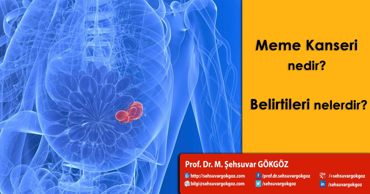 Meme kanseri risk faktörlerinin en önemlileri değiştiremeyeceğimiz risk faktörleridir.
sehsuvargokgoz.com/meme-kanseri-n…
#memekanseri #memekanseritani #memekanseritakip #memekanseriprogramı #memekanseribursa #muayene #memeultrasonu #mememr #mamografi #doktor #erkentanı #tedavi #memecerrahi