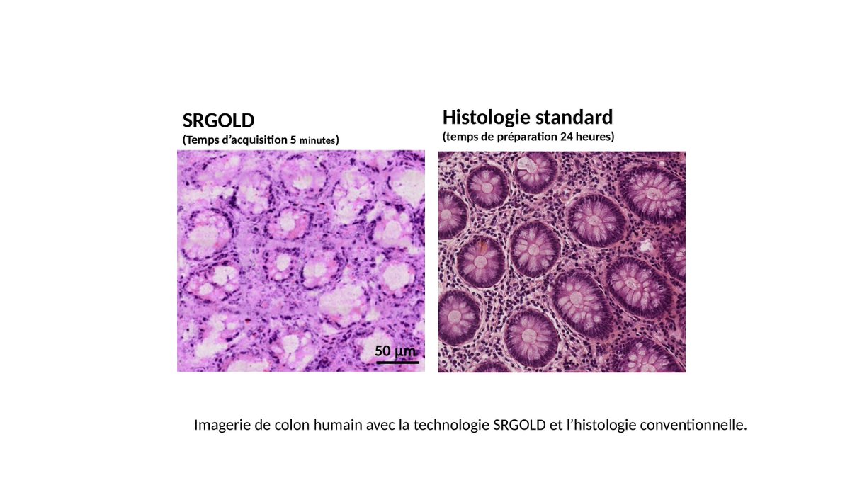 SATTse_'s tweet photo. #imagerie moléculaire des tissus pour applications médicales https://t.co/i9PqSbMPZm @ReseauSATT | maturation #SRGOLD @CNRS @SATTse_ @InstitutFresnel @univamu @iCarnot_STAR @Fast_Spor_in https://t.co/k7AmUhpatk