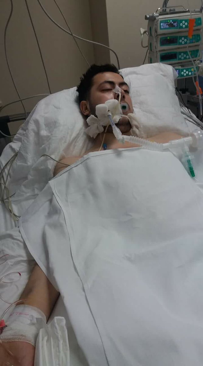 Kıymetli dostlarım  giresun  devlet hastanesi yoğun  bakımda yatan oğlum  için acil (A+Pozitif) kana ihtiyacımız var kan vermek isteyen arkadaşlar 0535 392 68 95 den beni arayabilir RT YAPALIM ARKADAŞLAR