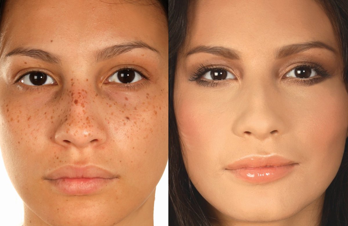 CovermarkUK's tweet photo. Our COVERMARK FOUNDATION Offers natural looking coverage ✔ Conceals even the most intense discoloration ✔Conceals any skin imperfections ✔ Evens out skin surface irregularities ✔ &amp; is suitable for all skin types ✔ 💜 https://t.co/tSugAY047X https://t.co/21qmnXLPEb