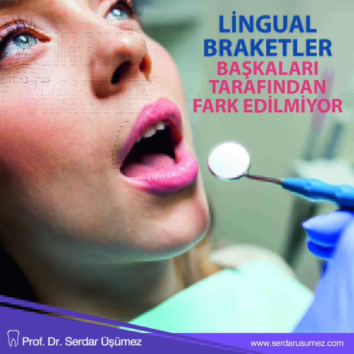 Lingual braketler başkaları tarafından fark edilmediği için de hastalar özgürce gülümseyebilir.
.
.
.
#serdarusumez #dis #dissaglıgı #teethhealt #caprasık #ortodontik #tratment #saglık #health #ortodontik #healthlife #ortodonti #cocuk #child #tedavi #istanbul #lingual