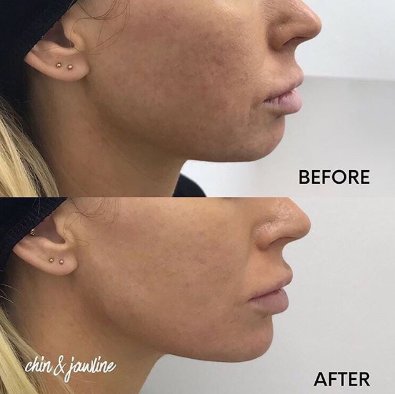 Biolite UAE tweet media