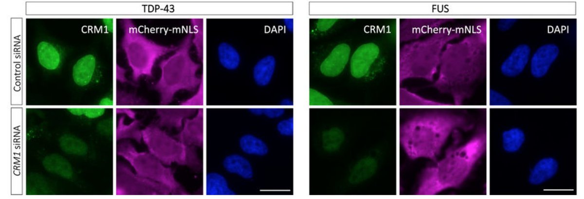 ALSResForum's tweet photo. A new study suggests that TDP-43 and FUS build up in the cytoplasm in neurons in #ALS by passive diffusion, stoking the debate about how to reduce this potentially key source of neurotoxicity in the disease https://t.co/GAyjS0tFI2 @NatureComms #NuclearExport #XPO1 #CRM1 https://t.co/OpshTcGtk8