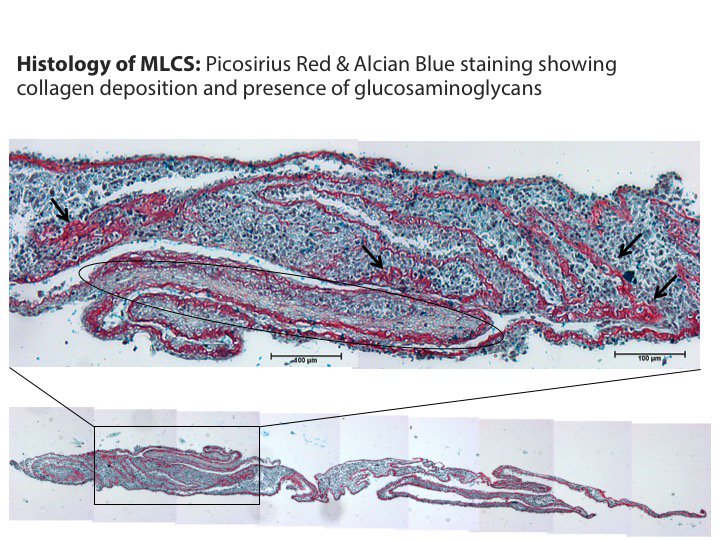 ElizabethKapasa's tweet photo. 3/3 This histological staining shows the presence of important components for bone in the MLCS - collagen! Current results have demonstrated the feasibility of creating and using osteogenic MLCS to create 3D tissues in vitro for bone tissue engineering. #CDTTweCon https://t.co/X8H7VTIQyH