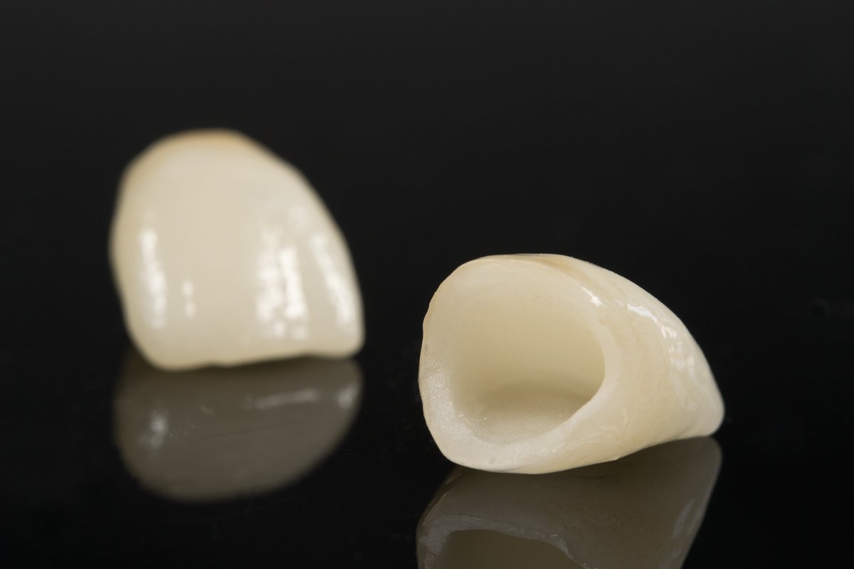 Treat Your Decayed Teeth with Dental Crowns
(ow.ly/J4uj30jmvky)

#dentalcrown #decayingteeth #damagedtooth