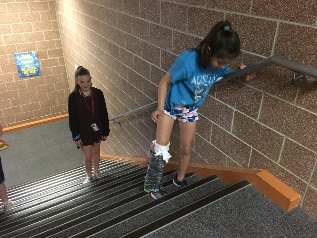 KLothamer's tweet image. Can you design and build a prosthetic leg? These scientists can! #EngineersAtWork @RSIHawks