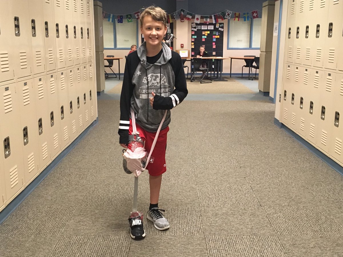 KLothamer's tweet image. Can you design and build a prosthetic leg? These scientists can! #EngineersAtWork @RSIHawks