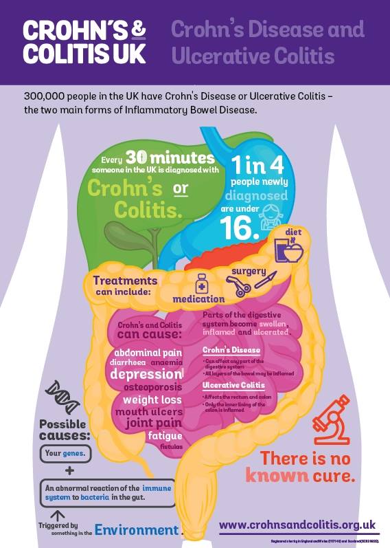 CrohnsColitisUK's tweet image. It's #worldIBDday! RT to improve understanding of #Crohns Disease &amp;amp; Ulcerative #Colitis - the 2 main forms of #IBD, which affects 300,000 people in the UK &amp;amp; millions more worldwide. 

Please help transform the lives of people with IBD: 

💜 Text GUTS to 70500 to donate £5