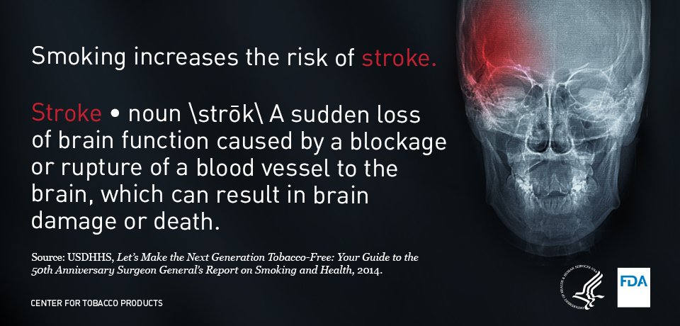 can you have a stroke from smoking cigarettes It's #NationalStrokeAwarenessMonth! Smoking cigarettes can cause plaque  buildup in your arteries that can lead to stroke. #StrokeMonth