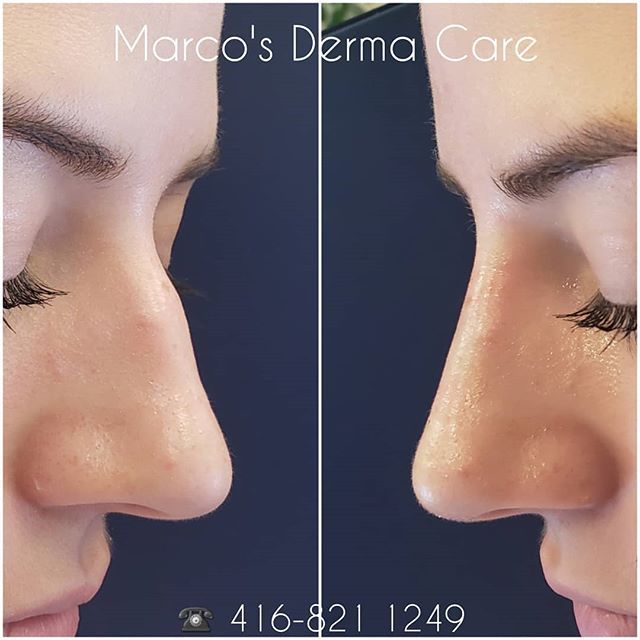 marcos derma care