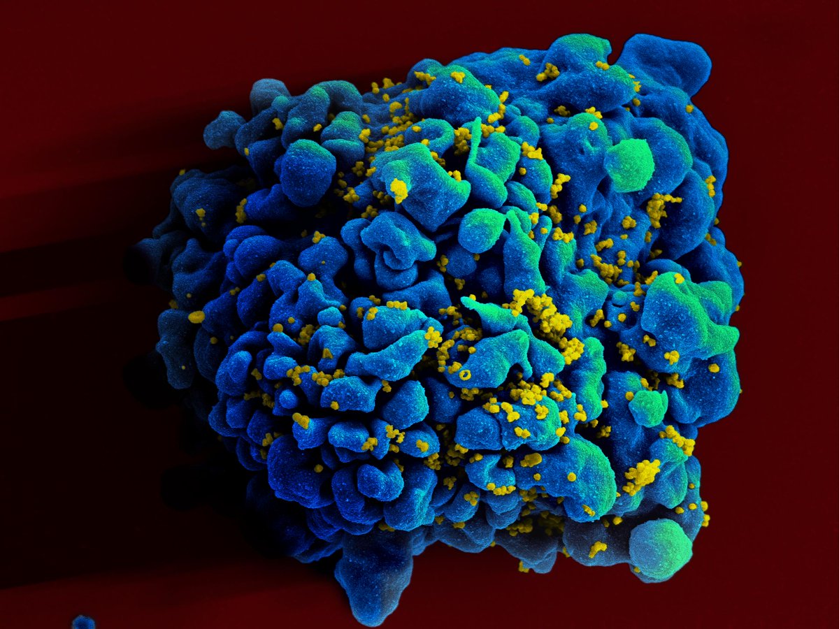 creativexscape's tweet photo. Wow! 😮 "Vaccine trials cost much more than those for treatments and because they involve healthy populations. The trials include up to 5,000 subjects." Great insight on the uniqueness of vaccine clinical trials. 💉 @HorizonMagEU #HVAD https://t.co/iVF4Xd4BsA