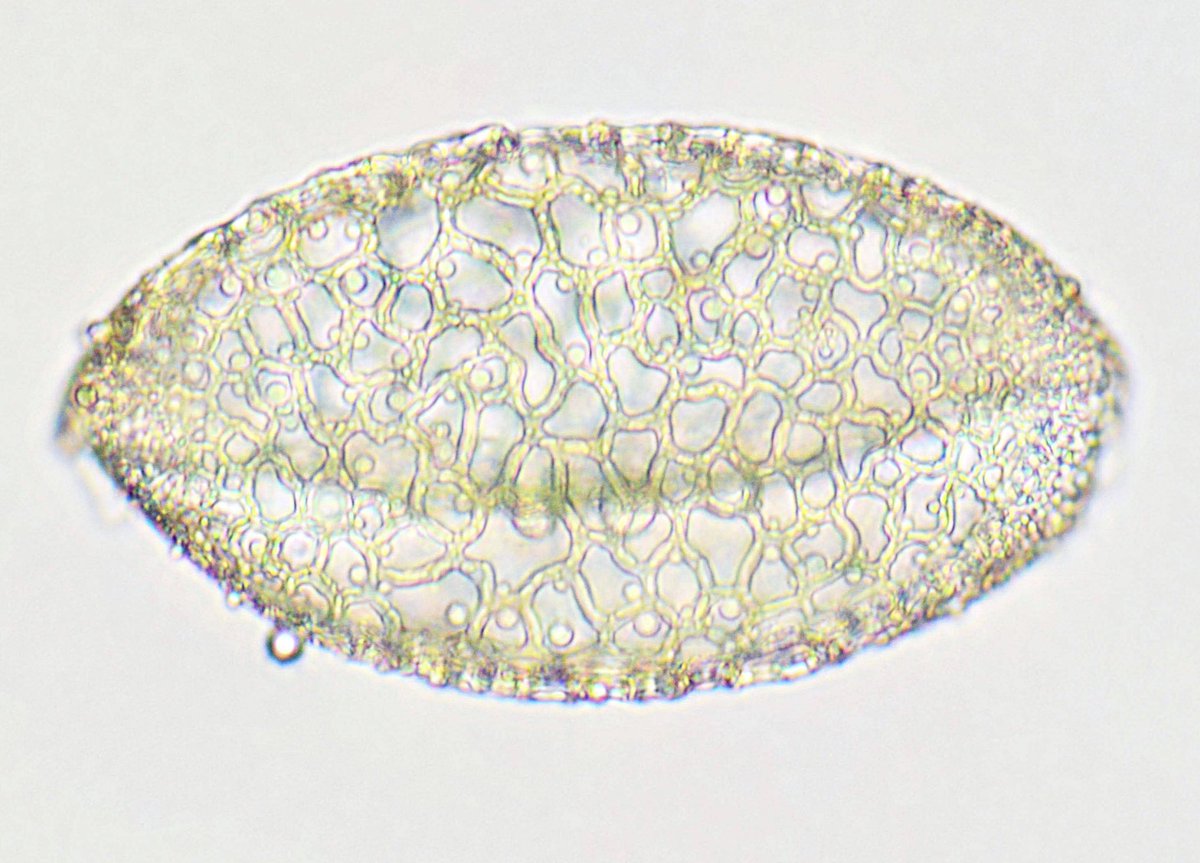 M31nebula ユリの花粉です アルコールで油分をとったあと塩酸につけると花粉の中味が出てきます この処理をすることで表面の模様が見やすくなります 顕微鏡 花粉 ユリ