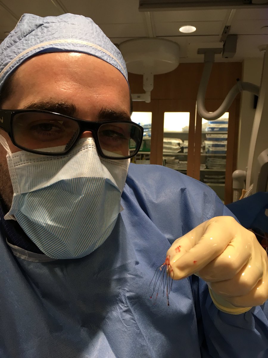 1 of 2 #filteroutfriday  — 10 yr old G2 filter #IRad and #loopsnare for the win. Fellow loving flying solo with the #Medstudent assisting. #nofilter #filterOUT
