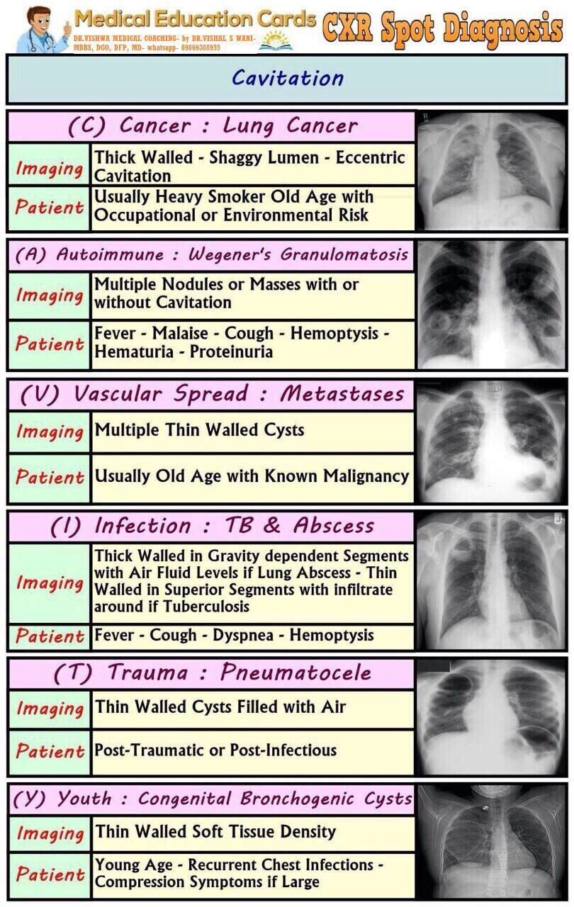 Small And Narrow Chest, Spot Diagnosis