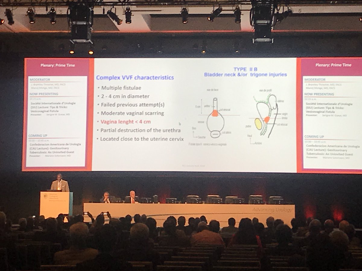 IVUmedAUC (@ivumedauc) on Twitter photo Appreciating bilateral global surgical education at plenary #AUA18. Dr. Seringe Gueye <a href="/drsmgueye/">Serigne Magueye GUEYE</a> presenting tips and tricks for vesicovaginal fistula management <a href="/IVUmed/">IVUmed</a> <a href="/Mohamed26343908/">Mohamed Jalloh</a> Appreciating bilateral global surgical education at plenary #AUA18. Dr. Seringe Gueye <a href="/drsmgueye/">Serigne Magueye GUEYE</a> presenting tips and tricks for vesicovaginal fistula management <a href="/IVUmed/">IVUmed</a> <a href="/Mohamed26343908/">Mohamed Jalloh</a>