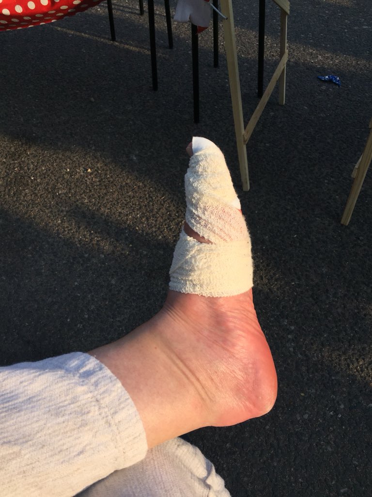 stewieandmilou's tweet photo. WTF ? #RoyalWeddding injury #noalcoholinvolved 🙀🙀 https://t.co/Z3s5zofJ4k