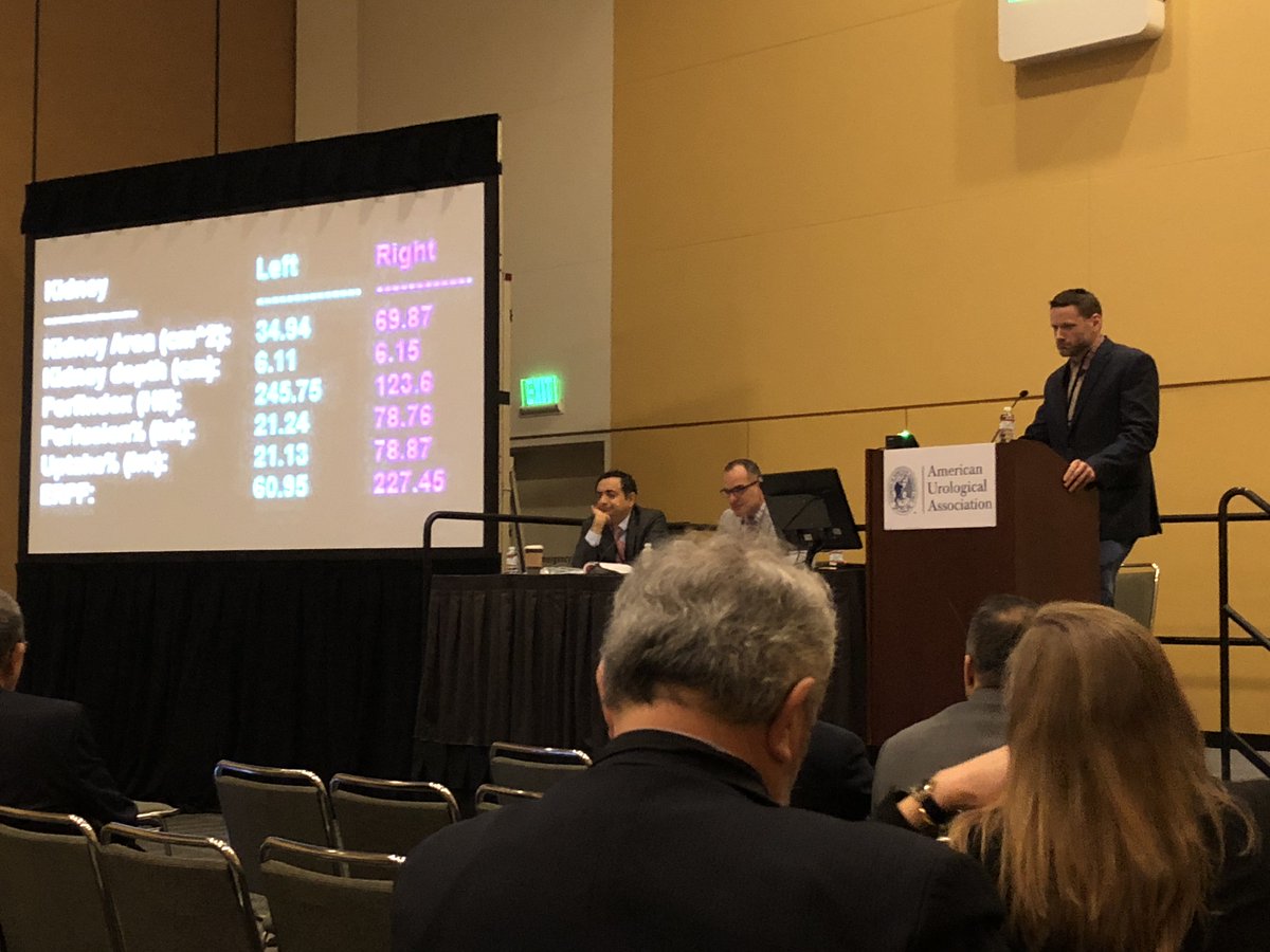 D_T_Jensen's tweet photo. Zach Panfili presents a video of robotic upper pole ureterectomy at #aua2018 @KHS_Urology @dduchenemd https://t.co/9CzDvOVN7B