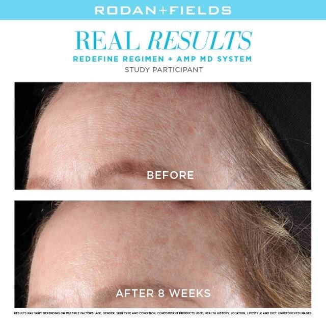 SaranacLikes's tweet photo. #LoveTheSkinYoureIn♥️ #RFLife #RollBackTime #SaranacLikes💗 #LifeChangingSkincare #RFBeforeAndAfter #AgingBackwards👶🏼 #TheTimesTheyAreAChanging🎶 #StartEachDayLikeItsYourBirthday🎉
Find out more here:
https://t.co/rwqEQUfTHO https://t.co/Gw1w2ToZSP