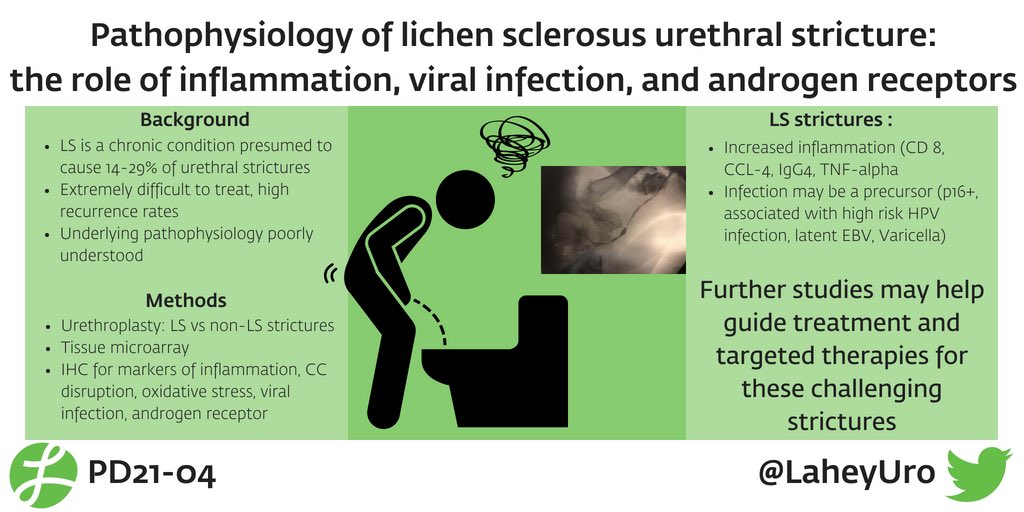 AliLevyMD's tweet photo. But wait there’s more! Defining pathology of strictures due to LS @alexjohnvanni #AUA18 @LaheyUro @SocietyGURS https://t.co/Ksr2lFsX2v