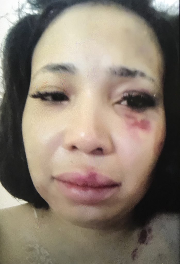 AdvoBarryRoux's tweet photo. Mshoza was cheating with a policeman &amp; her husband found out and it all came down to this. 💔 She's currently in hiding from the husband. I can only share one picture the rest of the pictures are really bad. 😔 😢 😭 💔 https://t.co/ZHUKl1jjvH