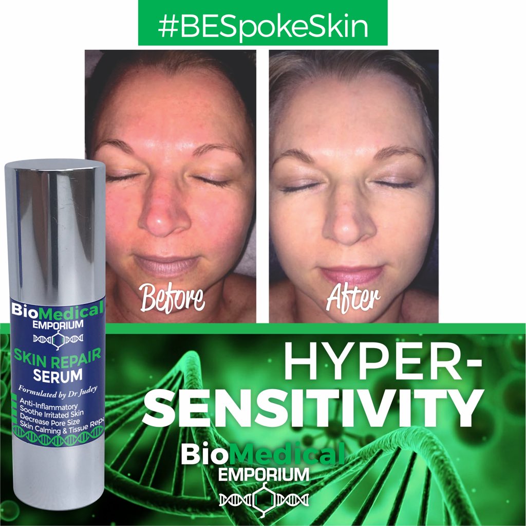 biomed_emporium's tweet photo. The Skin Repair Serum is a ultra calming Serum for skin that shows an increased fragility and over-reactiveness toward environmental factors. Apply twice daily. #ultracalming #skinsensitivity https://t.co/zemKsXQM6L