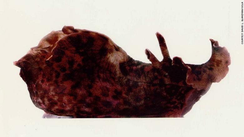 CNN's tweet photo. Scientists have successfully "transplanted" a memory from the nervous system of one snail into another https://t.co/cV2RIBN1Dl https://t.co/gee66enaN9