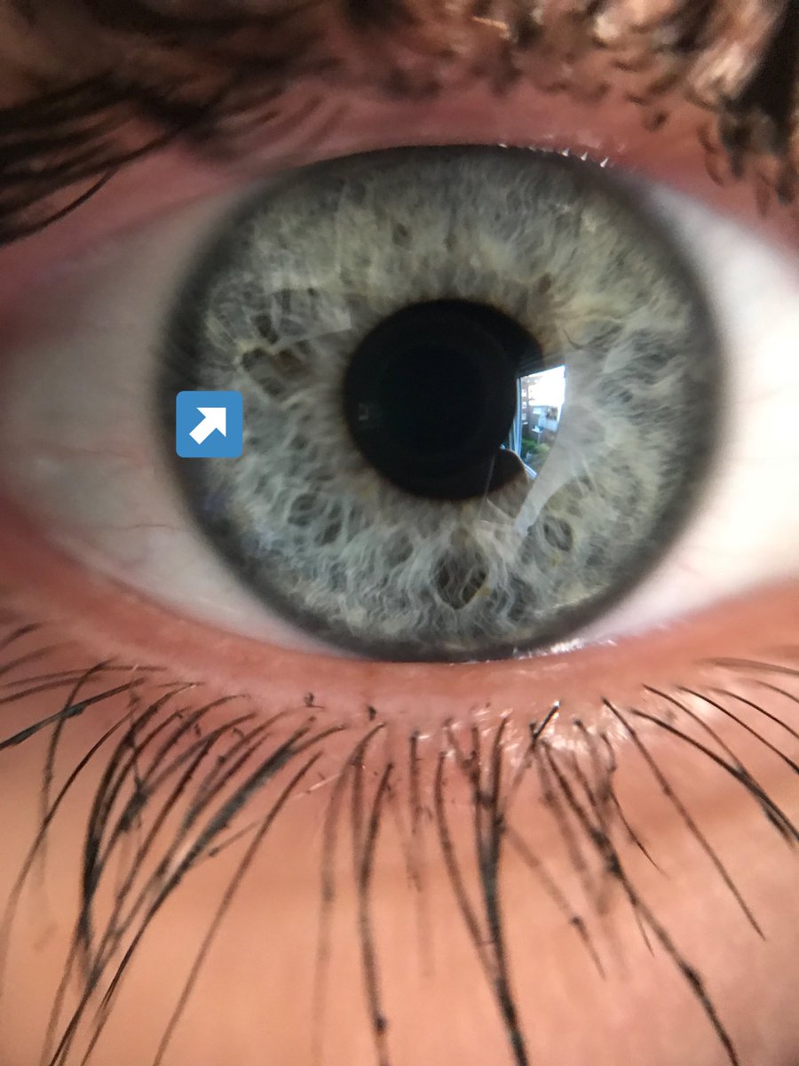 michelleeeee9's tweet photo. Γh ist das etwas das #chaos Herz in meinem Auge πβ€οΈ @kayefofficial #ModusBox #linsen #macro https://t.co/d6yilC5ts9