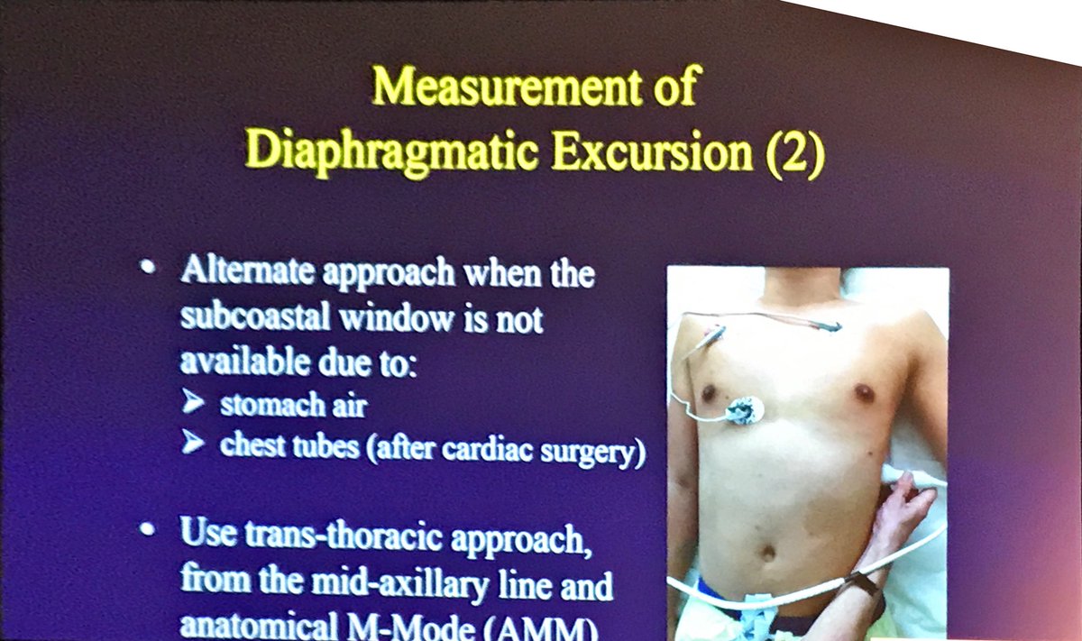 2 ways to measure diaphragm excursion #POCUS #SGANZICS