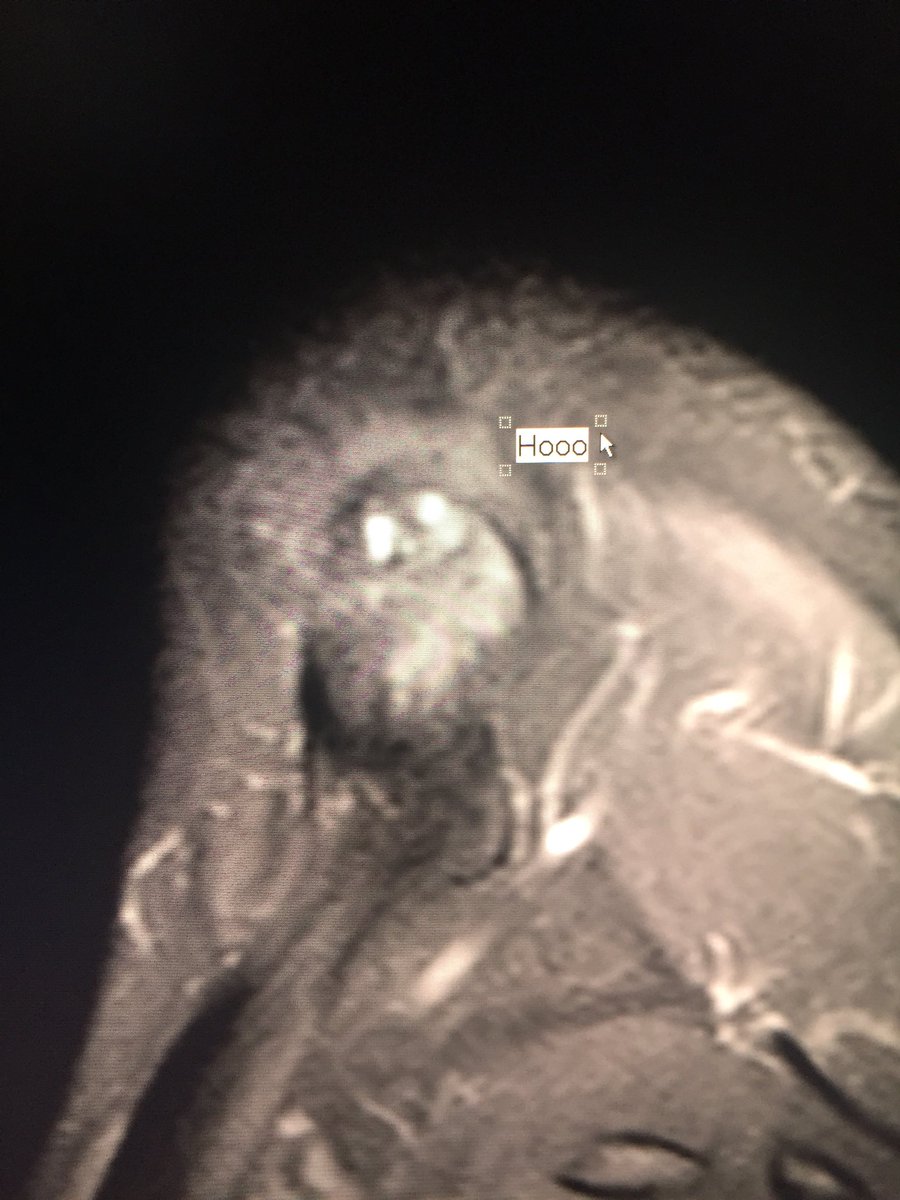 adam zoga (@azoga) on Twitter photo 