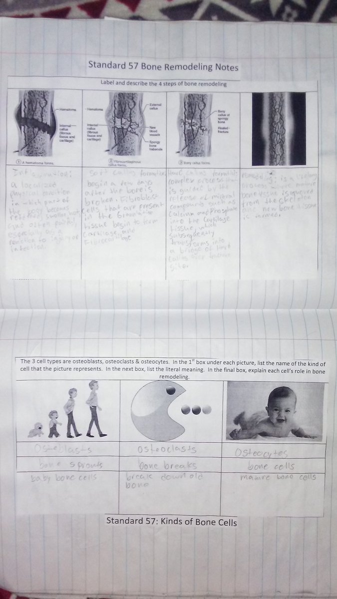 pollockroyce12's tweet photo. St. 57 Ds: bone cells notes
#rhsbms https://t.co/MPWEYtcJjM