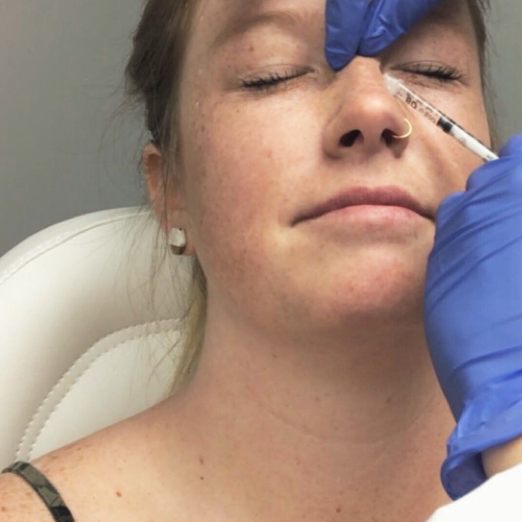 Retweet if you want Botox 💉😘