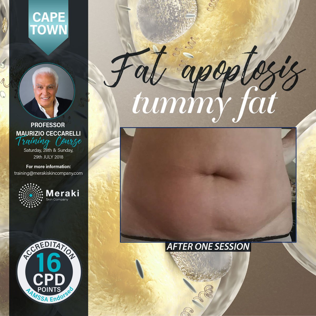 MerakiSkinCo's tweet photo. Professor Cecarelli uses a specific solution to reduce excess fat around the stomach area.

World-class training event with Prof Ceccarelli at the 12 Apostles in July! 

Book now to avoid disappointment. 

To Register visit: 

F ... https://t.co/0FgjOUVtqh https://t.co/FYZx9aIcvr https://t.co/5kHvXCvVRN
