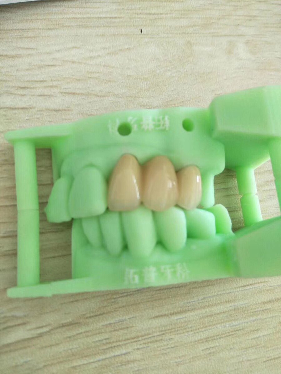 TOP_dentallab's tweet photo. Digital printing work by us at TOP Dental Lab in Shenzhen China. #topdental #topdentallab #dental #denture #digital #3dprinting #outsourcing #madeinchina #zirconium https://t.co/fBxsedaqJ9
