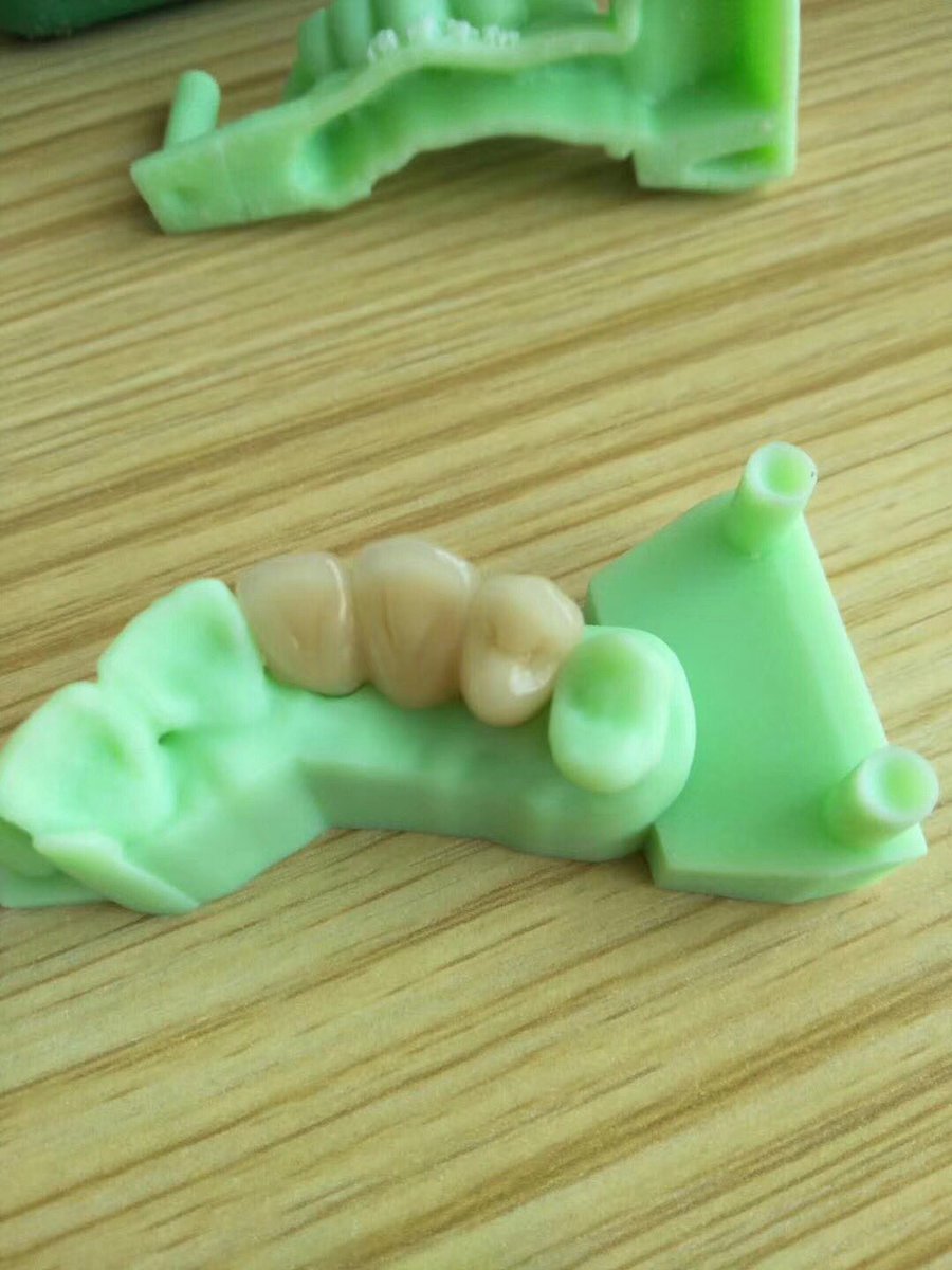 TOP_dentallab's tweet photo. Digital printing work by us at TOP Dental Lab in Shenzhen China. #topdental #topdentallab #dental #denture #digital #3dprinting #outsourcing #madeinchina #zirconium https://t.co/fBxsedaqJ9