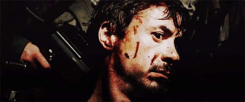 토니 '미용상처' 스타크 모음