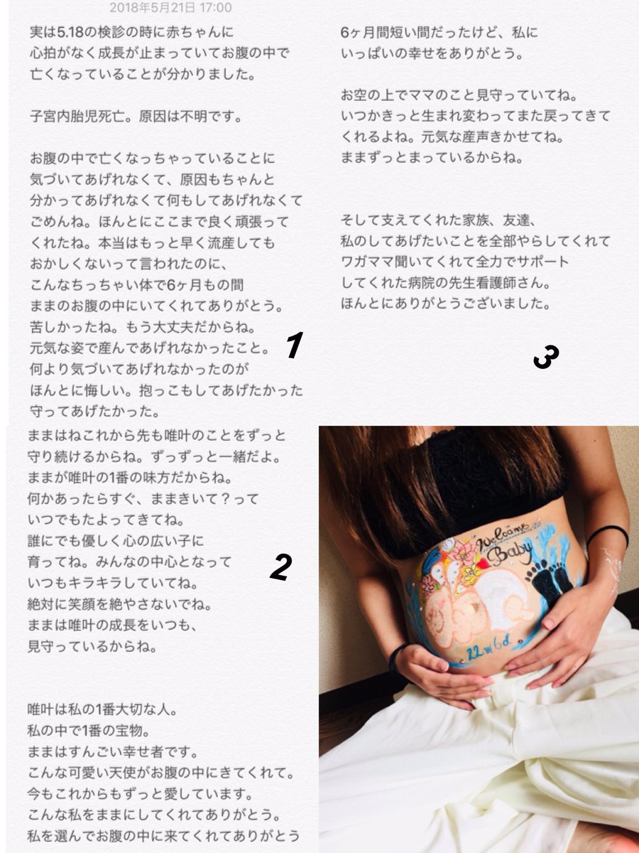 sy___0521's tweet photo. 報告。 

※気分悪くなる人はみないでね。

H30.5.21 
9:24 290ｇ 26cm 普通分娩。
予定日より3ヶ月早い、23w1dで
可愛い天使を出産しました👼💓
名前は唯叶(ゆいと)君です。

苦しい中最後までよく頑張ったね。
この子に出会えてほんとに幸せです。 https://t.co/aW4c6iU48q