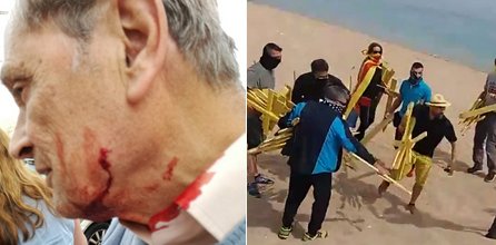 AlbanoDante76's tweet photo. Fa tot just 3 dies vaig estar a Canet de Mar. Vam compartint idees, inquietuts i debats. El que hem vist avui és tot el contrari: violència, manca de respecte, agressivitat. En dues imatges: CIVILITZACIÓ o BARBÀRIE. No passaràn. https://t.co/Othz4Dru3R