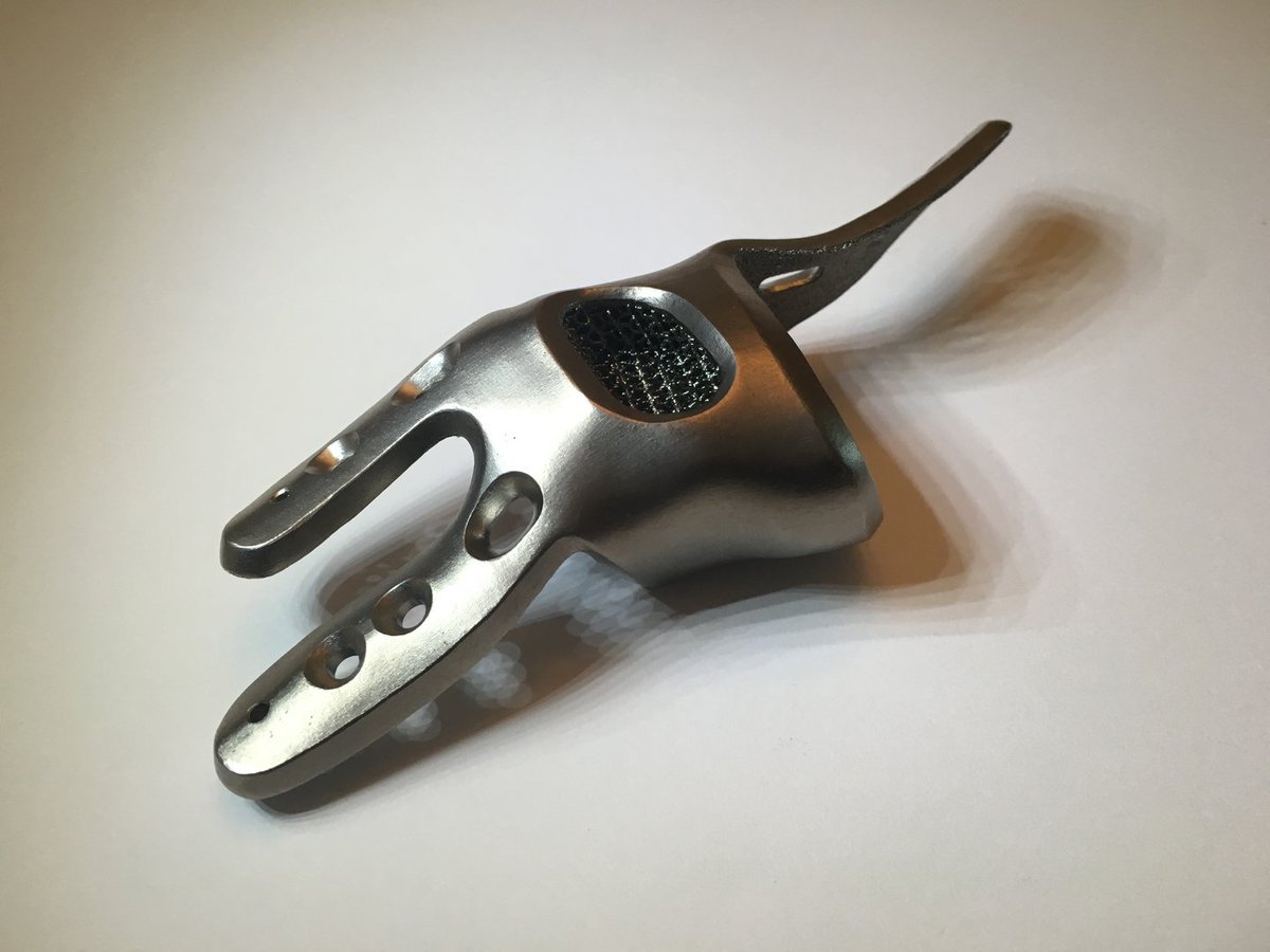 PeterCoffaro's tweet image. #AdditiveOrthopaedics Receives 510(k) Clearance for Patient Specific 3D Printed Bone Segments orthofeed.com/2018/05/21/add… #medical #3dprinting #FootAndAnkle #extremities #FDA #implants #medtech #orthopedics