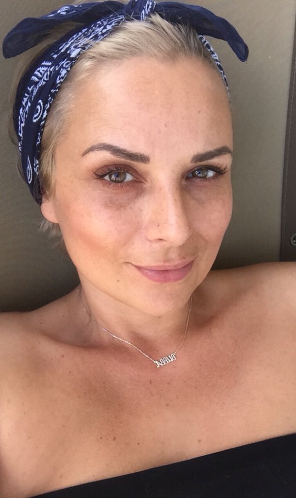spinspinsvgar's tweet photo. Freckles are out in full force 😎❤️🙌🏻
#NoFilterNoProblem https://t.co/b88kI0yefZ