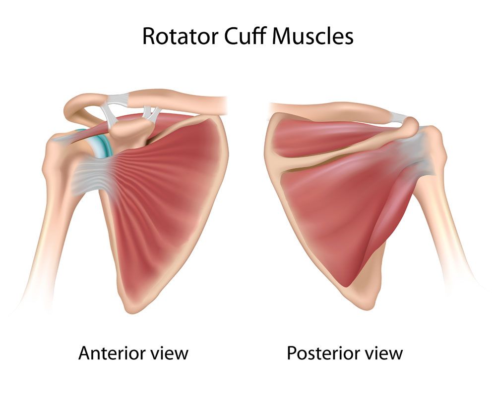 DrJeffPadalecki's tweet photo. #Rotatorcufftendonitis is commonly caused by repetitive overhead activities, such as throwing or lifting, or a rotator cuff injury. https://t.co/n2OINQtaGv https://t.co/T8C4lVNEuz