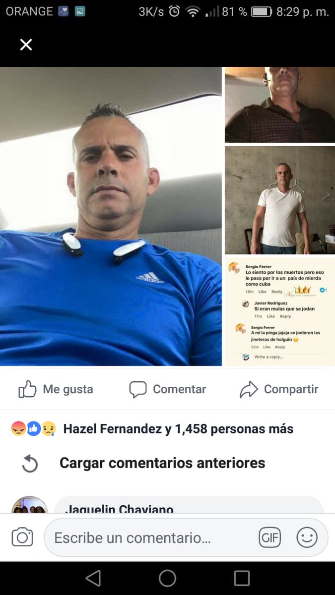 eiacosta's tweet photo. Este cabecita de alfiler, que parece sacado del show de los fenomenos de American Horror Story, es un vil gusano de origen cubano. Vean como se mofa de los muertos en accidente aereo, como hiena que enloquece con  sangre. Lo creen incapaz de un nuevo atentado como Barbados? Asco https://t.co/uUSkns2z86
