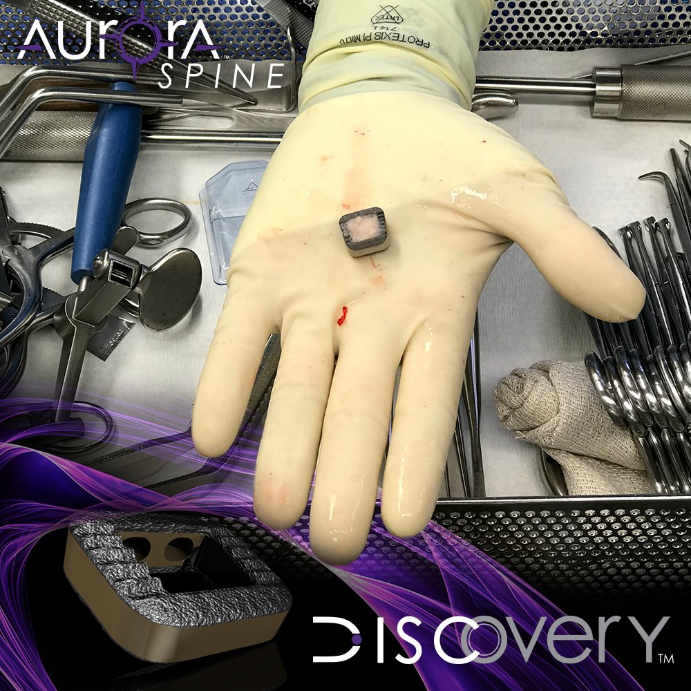 AuroraSpine's tweet photo. DISCOVERY™ is Aurora Spine's modern, minimally invasive ACIF interbody fusion cage with a trapezoidal design, manufactured with PEEK and coated with TiNano® titanium plasma spray coating. #surgery #surgeon #SurgeonLife #SurgeryTime #SurgeonTime #BackPain #Discovery #TiNano https://t.co/m09lcWKeeZ
