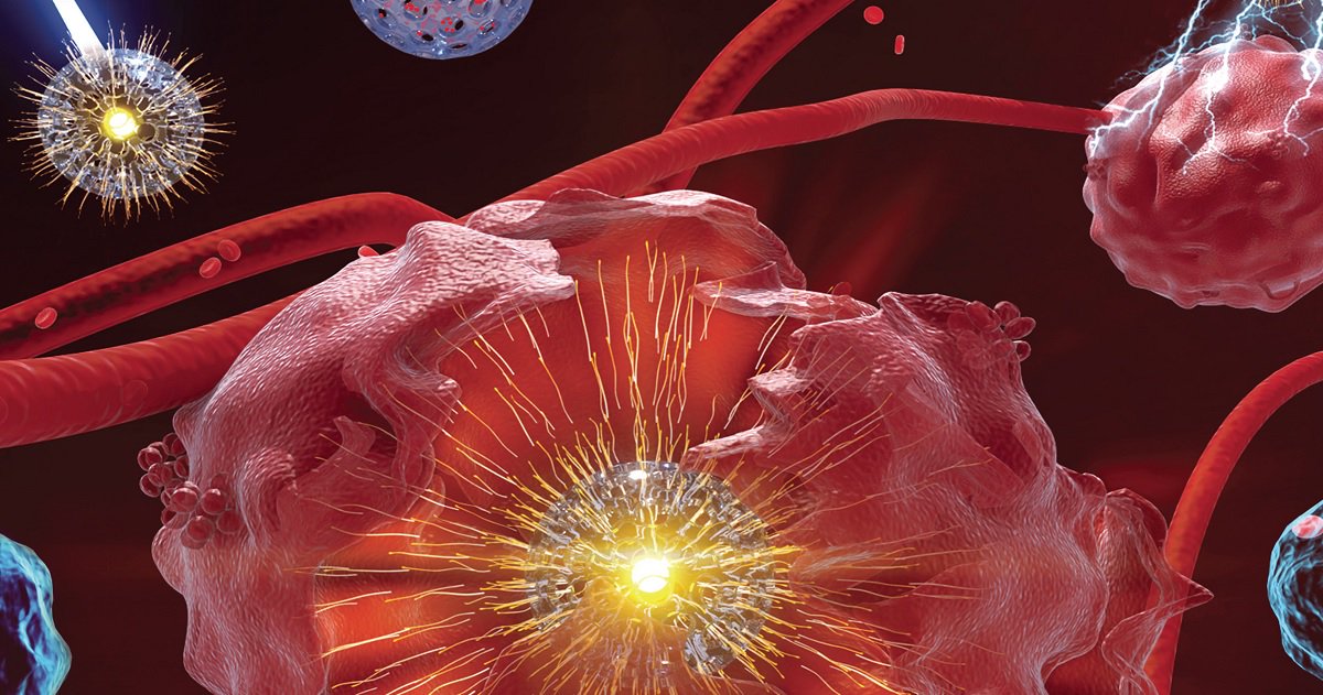 ACSNanotation's tweet photo. On this week's @acsnano cover: hollow persistent luminous #nanoparticles that utilize their large inner cavities and near-infrared afterglow for #tumor imaging and chemo/photodynamic therapies. Read the full research article: https://t.co/buPOhgrSgH #TumorTherapy #DrugLoading https://t.co/ifv7GiI7Ig