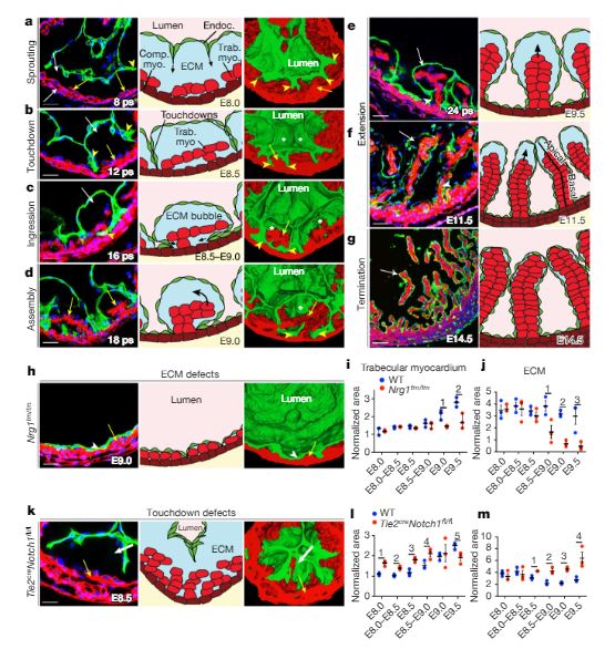 VictorChangInst's tweet photo. Control of cardiac jelly dynamics by NOTCH1 and NRG1 defines the building plan for #trabeculation – Our recent @nature paper published by @ Gonzalo_dlMonte https://t.co/Aw67IEd3Ff https://t.co/d8f2SIKWVt