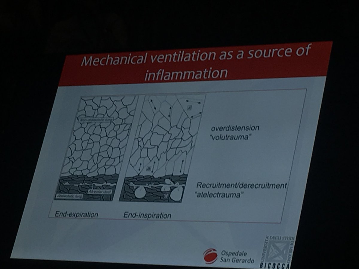 DrMCecconi's tweet photo. Great start of the joint @ESICM @ESA_HQ session on ventilation #EA18 #
@GicoBellani It's not good that a baby lung does the whole work. We need to protect the lungs by the effect of ventilation. In the OR should also ventilate carefully. Let's be gentle in OR &amp; ICU. https://t.co/duzO1wmnwv