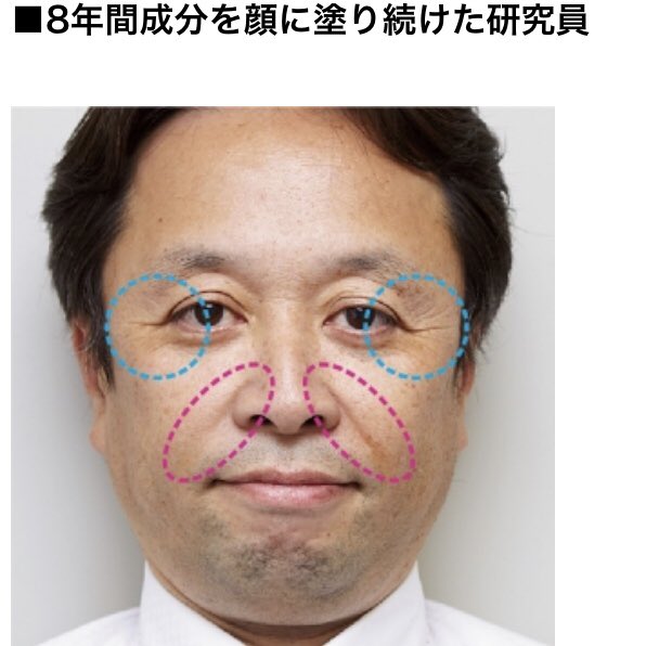 ﾘﾝｸﾙｼｮｯﾄが効果ない原因は主に4つ 効果的な使い方は保湿と順番 Pick Journal