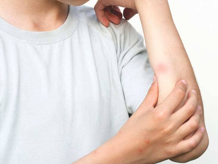 drtrinachiro's tweet photo. Bites &amp; Stings Natural Relief https://t.co/Ojze2ZmQao https://t.co/i4W2Is2nnr